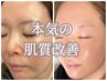 本気の肌質改善★陶肌トリートメント5回コース★オプション毎回1つ＋更に1回