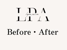 レピア 高槻店/韓国式LEPIA Before&After