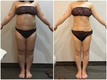 美容整体 ウェリナ 蟹江院/小顔矯正/骨盤矯正/痩身整体