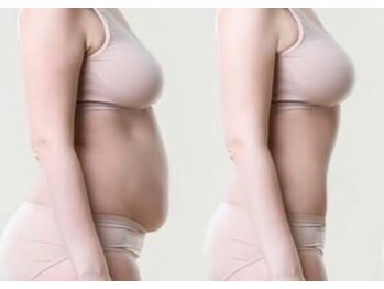 ヨサパーク 相模原中央店(YOSA PARK)の写真/《本格痩身》食欲の秋に食べ過ぎた脂肪を燃焼!"結果"と"質"にこだわる根本改善痩身で健康的な美ボディに♪