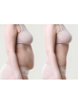 サイズダウンを目指したい