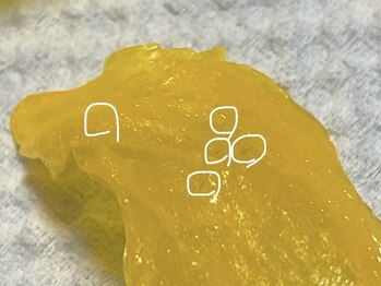 ウィズユー(with U)/鼻まわりの産毛