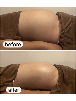 アネクル(ANECUL)/