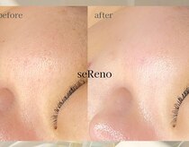 セレーノ 白金台(seReno)