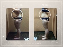 アバンダンティア 姫路店/★キャビテーション★