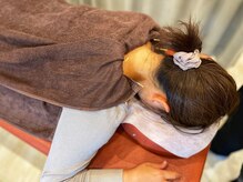 船橋はりきゅう整骨院/鍼施術の様子/肩こり/頭痛/船橋