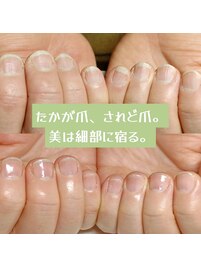 自爪を育て、美爪に導く施術