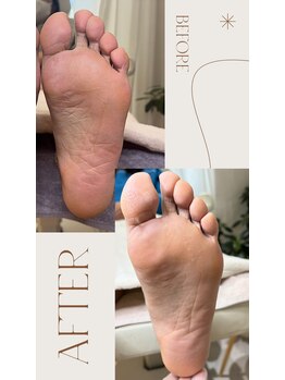 ポドウオーク(PODO WALK)/膝下オイルセラピー