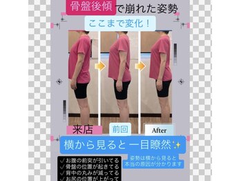 パワーパステル/骨盤後傾で崩れた姿勢の変化