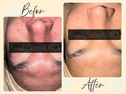 アルパカ(ALPACA)の写真