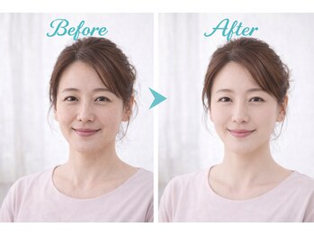 アプロ(Aphro)/別人級の変化