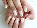 流行りのレース×イエロー