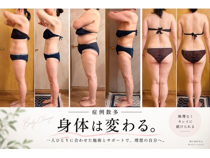 ルモナ(Rumona)の写真