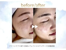 ルーム701(room701)/天王寺フェイシャル専門店