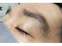 アンジェリーナ/メンズ眉脱毛/脱毛前