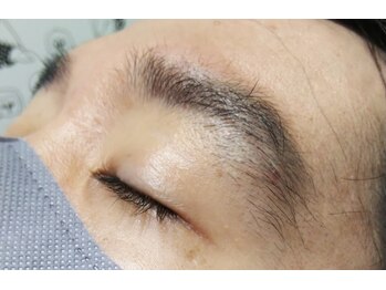 アンジェリーナ/メンズ眉脱毛/脱毛前