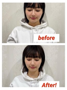 プレッシュ(Presh)/【小顔矯正】