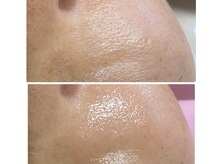 和の雰囲気（before＆after  ）