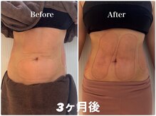 シフト 原宿店(SHIFT)/新規必見！4カップ/11,000