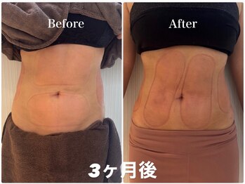 シフト 原宿店(SHIFT)/新規必見!4カップ/11,000