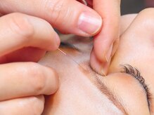 プロぺ鍼灸整骨院