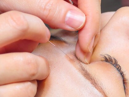 プロぺ鍼灸整骨院の写真