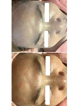 ロゼブランシュ(Rose Blanche)/