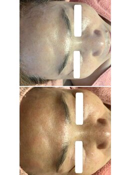 ロゼブランシュ(Rose Blanche)/