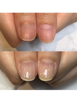 自爪育成ジェルネイルで爪を育む