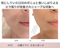 リアン(Lien)