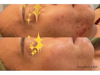 リムビューティー 自由が丘(RymBeauty)の写真