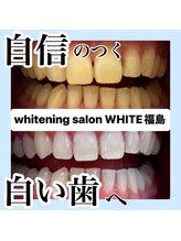 ホワイトニングサロン ホワイト(WHITE)/自信のつく白い歯へ
