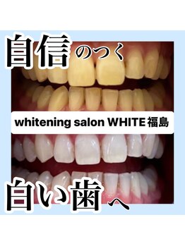 ホワイトニングサロン ホワイト(WHITE)/自信のつく白い歯へ