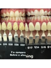 トウキョウスワーズ 池袋店(TOKYO SWRS)/#ホワイトニング #池袋 #渋谷