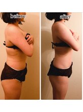 インディバジェム(GEM)/ビフォーアフター