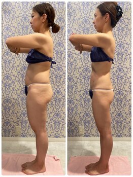 キッキー(Kicky)/before &after