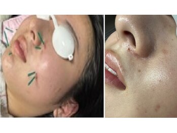 ふくだ鍼灸マッサージ治療院