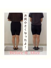 スタイルラボ高松/産後の骨盤矯正の効果♪