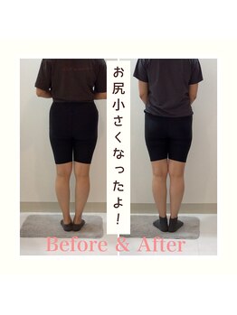 スタイルラボ高松/産後の骨盤矯正の効果♪