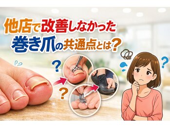 巻き爪じゅん 千葉駅前店/他店で改善しなかった巻き爪