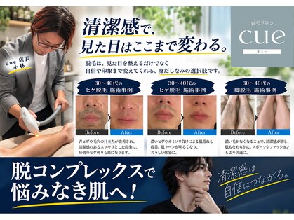 キュー(cue)の写真