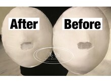 美極 トータルビューティー(美極 TOTAL BEAUTY)/恵比寿/小顔コルギ/エステ/