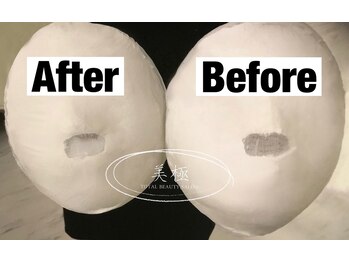 美極 トータルビューティー(美極 TOTAL BEAUTY)/恵比寿/小顔コルギ/エステ/