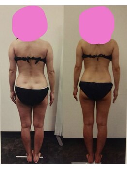 セルビューティー(Cell Beauty)/40代、筋膜リリース全身20回