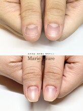 マリーロール 梅田店(Marie Laure)/自爪育成/深爪矯正/ネイルケア