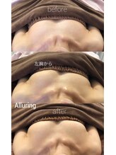 アルアリング 春日原(Alluring)/体験者様ビフォーアフター