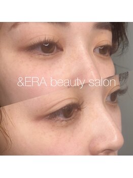 アンドエラ(&ERA)/LEDエクステ♪