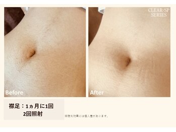 サロン ルアナ(salon luana)/気になる箇所もツルツルに☆