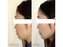 整え屋 レッド(RED)/阿波座/本町/小顔矯正/美容整体