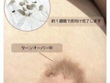 オンユ(ON’U)の雰囲気(【ローマピンク】あらゆる黒ずみにアプローチ!)